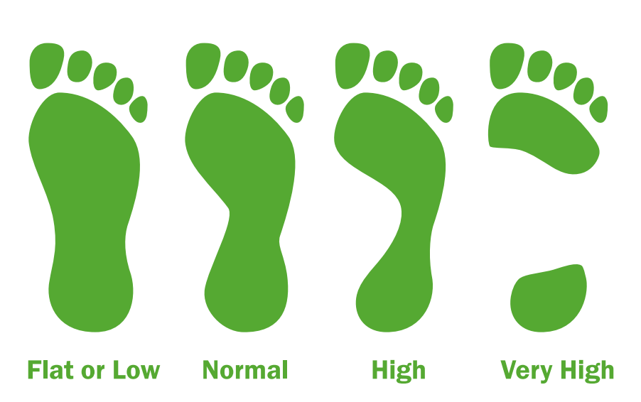 what is my foot type diagram