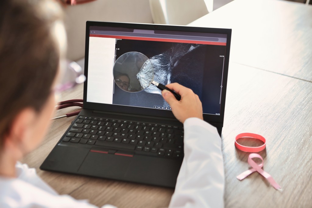 Female oncologist examining breast cancer cells closely with a magnifier on her laptop while viewing a breast MRI.